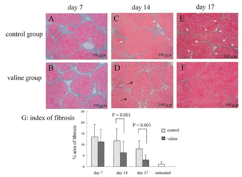 Affect of L-valine on the CCl4-induced liver fibrosis.