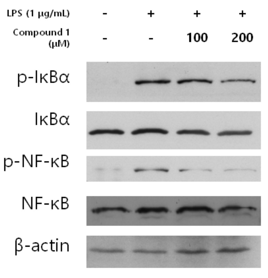 Fig.9 Mechanism of Citrusin XI through NF-κB signaling pathway.