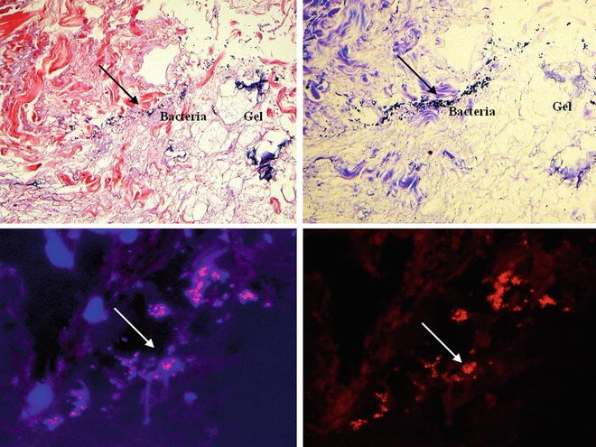 DAPI staining and PNA-Fluorescence in situ hybridization (FISH) were used in combination for detection of staphylococci.