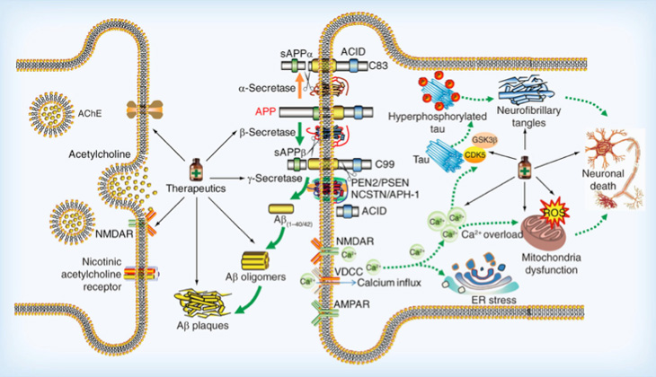 Alzheimers Disease