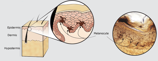 Anti-pigmentation-1.png