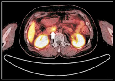 The DOTATOC for scanning